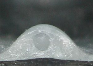 イボ
