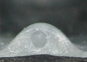 イボ